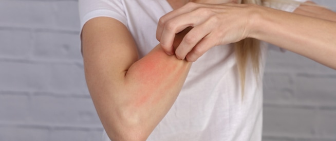 How to Treat skin allergy and what are its implications